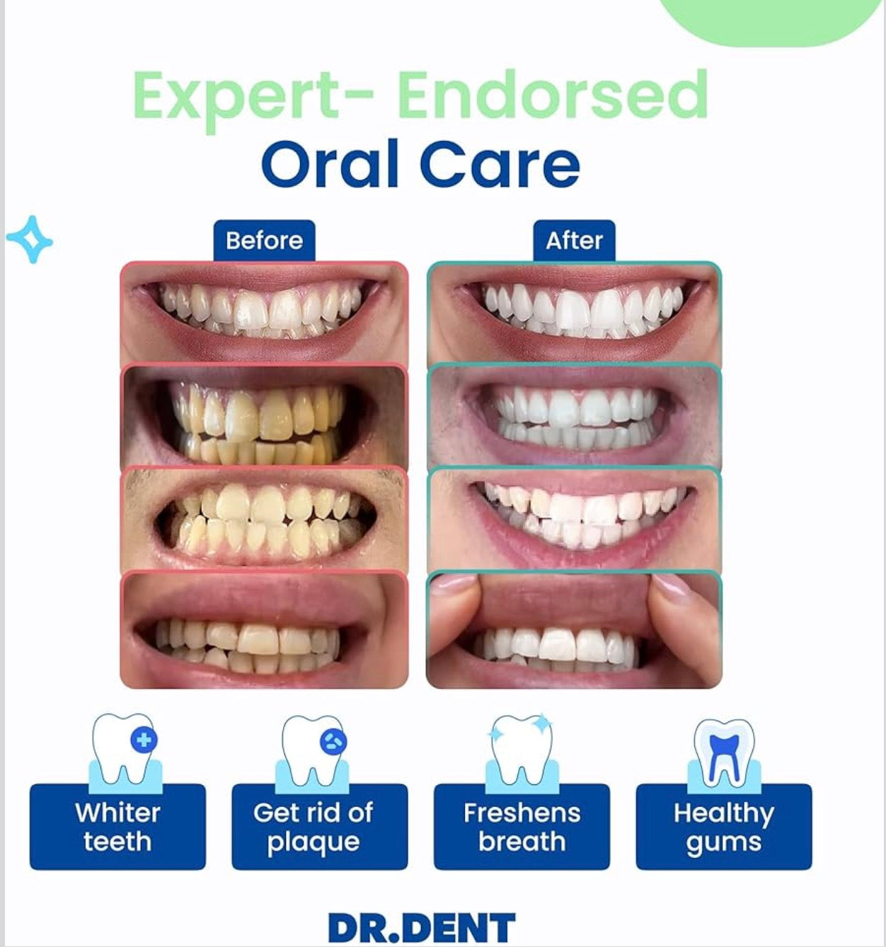 Blancheur Éclatante & Soin Ultra-Efficace pour Dents Sensibles