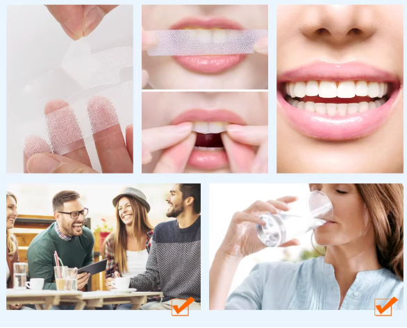 Bandes Dentaires 'ULTRA' Concentrée Anti-Taches —  Tabac & Café ❌ ⭐️