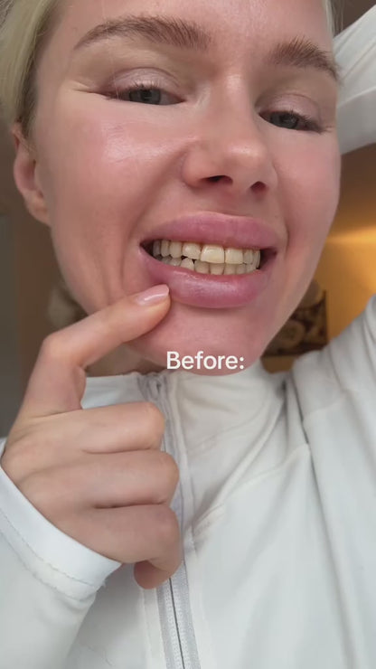 Kit Blanchiment Professionnel – Effet Blanc Immédiat & Longue Durée⭐️🏅